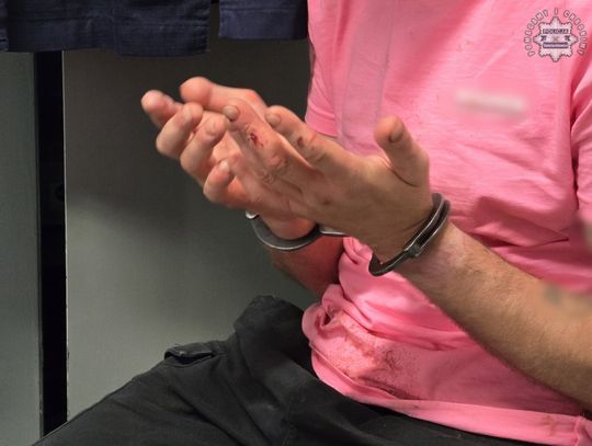 Dentysta pobity w gabinecie. Sprawca napaści wcześniej ukradł mu portfel