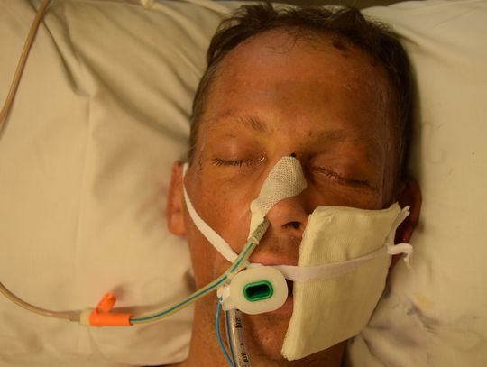 Ranny mężczyzna trafił do szpitala, nikt go nie zna. Policja publikuje zdjęcia i prosi o pomoc