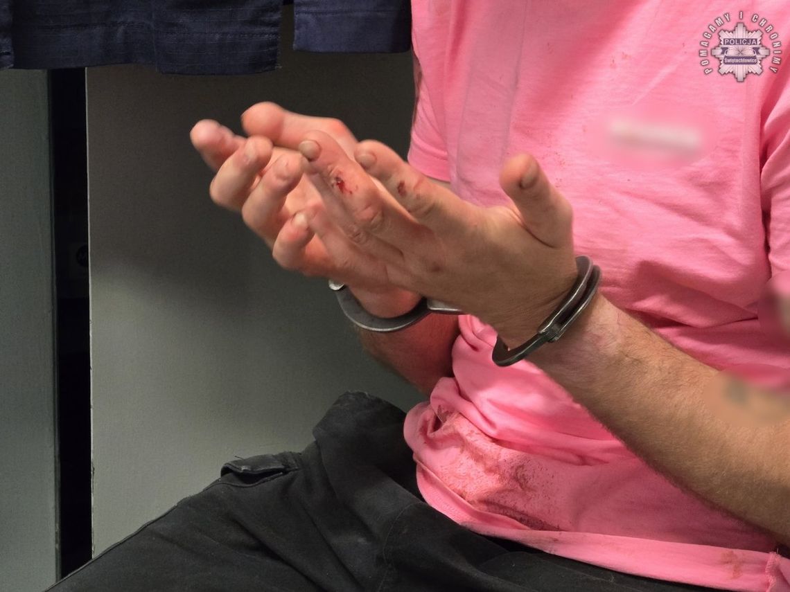 Dentysta pobity w gabinecie. Sprawca napaści wcześniej ukradł mu portfel