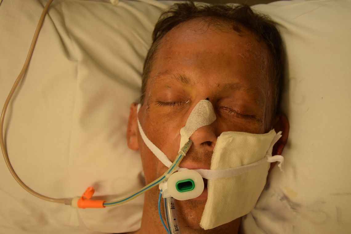 Ranny mężczyzna trafił do szpitala, nikt go nie zna. Policja publikuje zdjęcia i prosi o pomoc